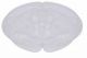 RZ Round Transparent Container 5 Sections With Lid
